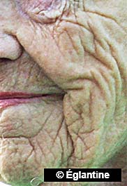 Aged face