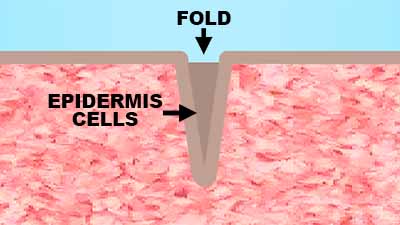 Epidermis formation inside a cutaneous fold