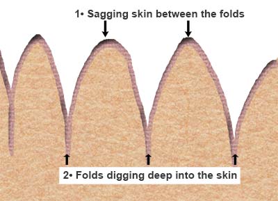 Folds ups and down