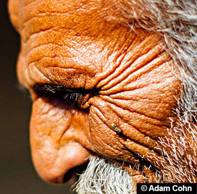 Body orifice folds around the eyes