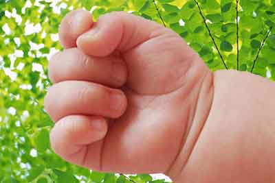 Permanent horizontal folds on the wrist of a newborn baby