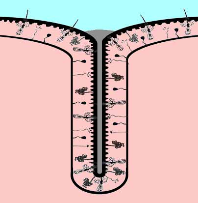 Bodily wastes inside a cutaneous fold