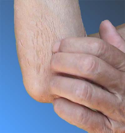 Four-finger grooming leaves lots of nail marks