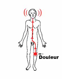 La douleur voyage jusqu'au cerveau