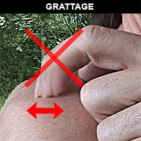 Exemple de grattage