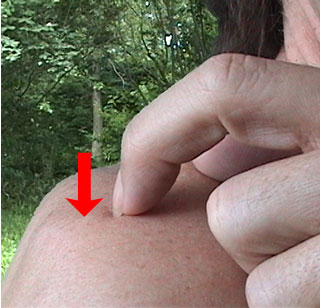 Pressure grooming a fold ccrossing