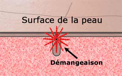 La démangeaison se trouve juste sous la surface
