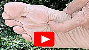 The pain is in the skin - Video